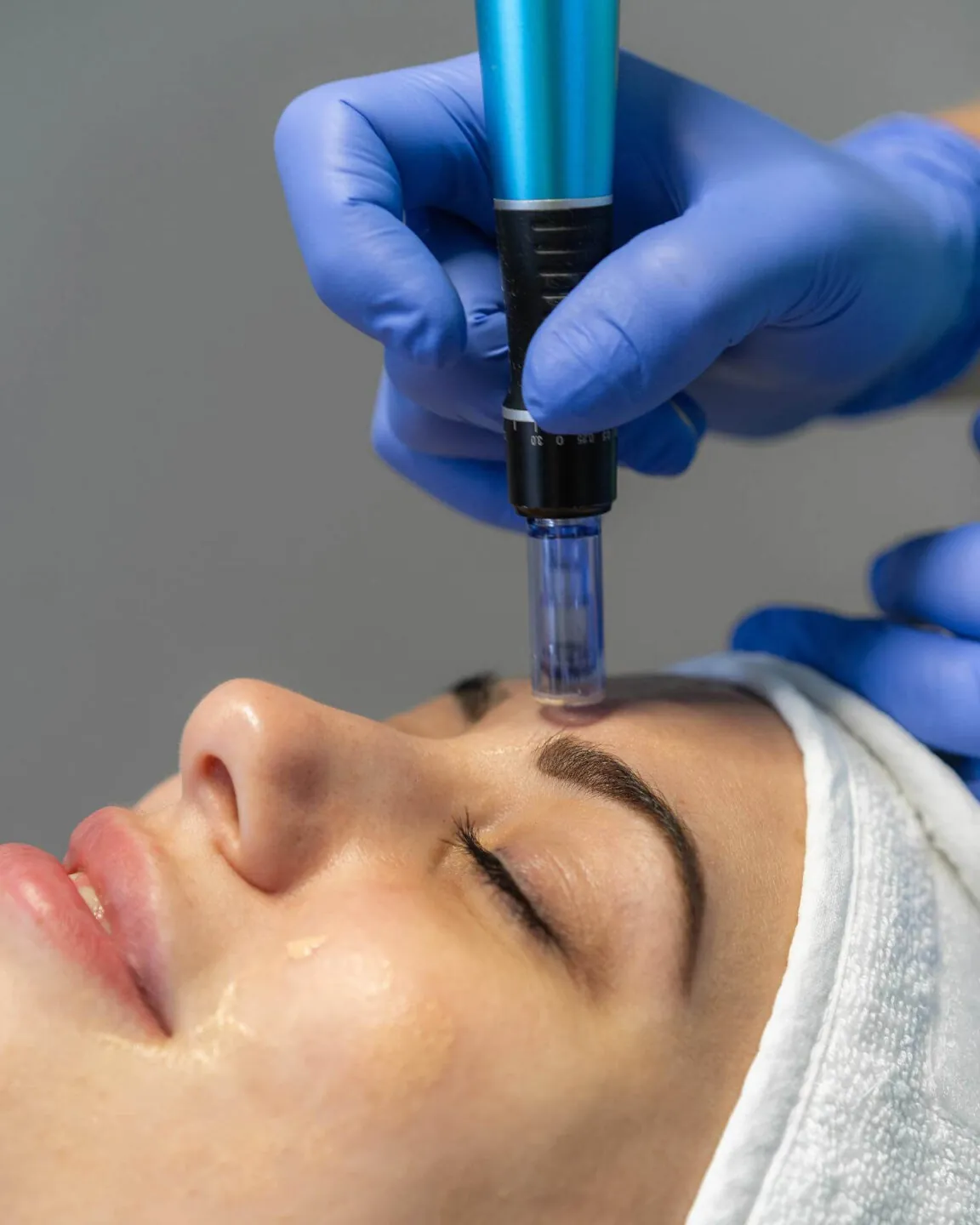 Napredni Anti-Age i neinvazivni lifting